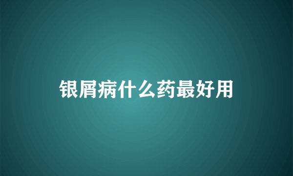 银屑病什么药最好用