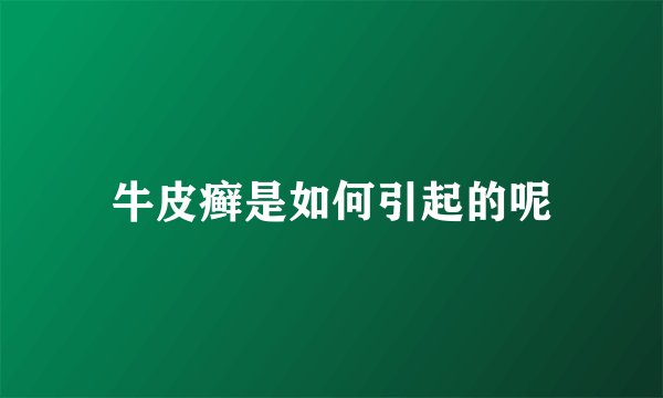牛皮癣是如何引起的呢