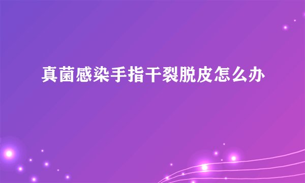 真菌感染手指干裂脱皮怎么办