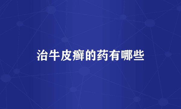 治牛皮癣的药有哪些