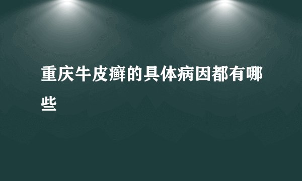 重庆牛皮癣的具体病因都有哪些