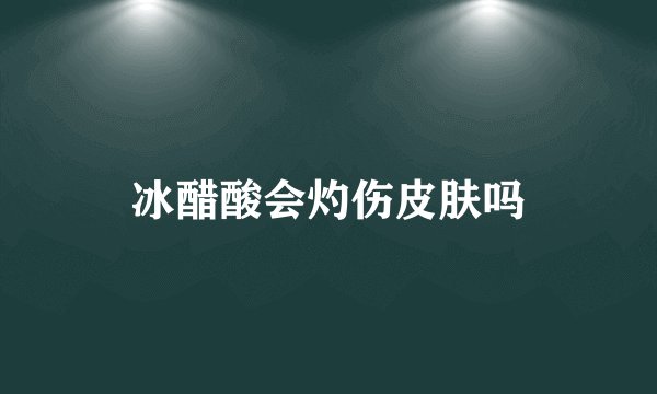 冰醋酸会灼伤皮肤吗
