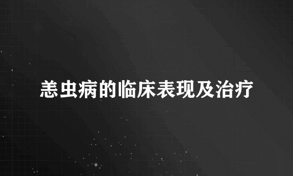 恙虫病的临床表现及治疗