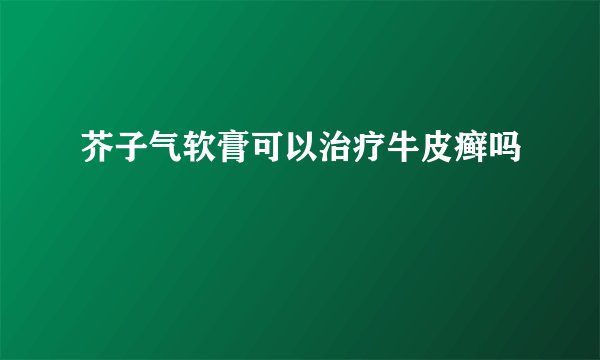 芥子气软膏可以治疗牛皮癣吗