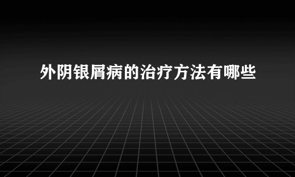 外阴银屑病的治疗方法有哪些