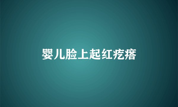 婴儿脸上起红疙瘩