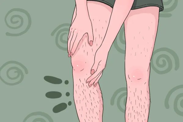 怎样去腿毛