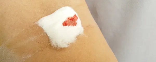 刀口药的功效