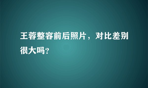 王蓉整容前后照片，对比差别很大吗？