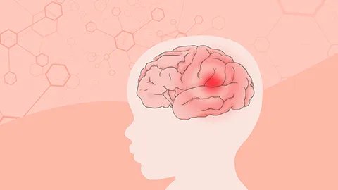 脑血栓偏瘫针灸有用吗