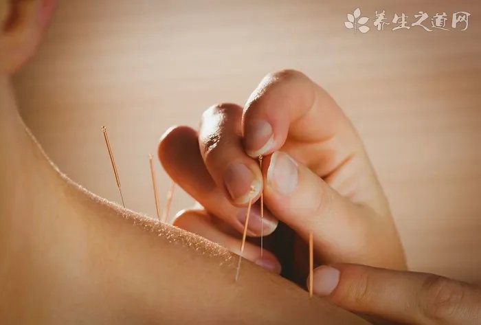 广州蛇根草