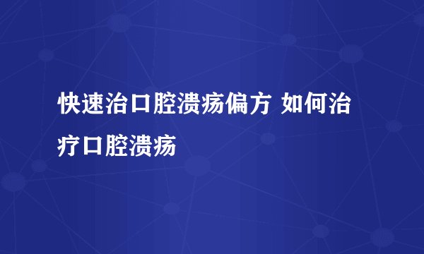 快速治口腔溃疡偏方 如何治疗口腔溃疡