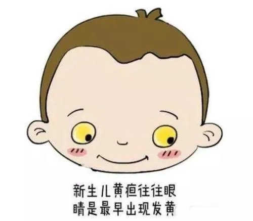 新生儿黄疸护理