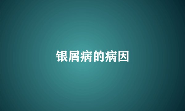 银屑病的病因