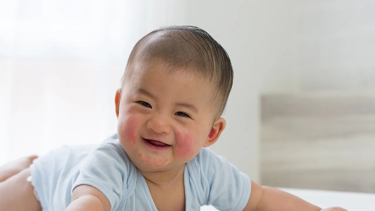 婴儿腹泻症状有哪些