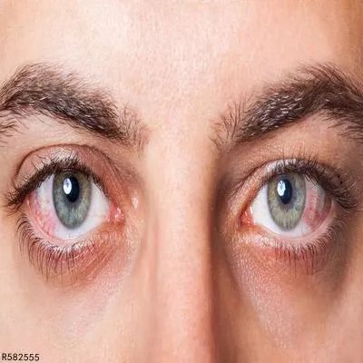 青光眼会出现视力减退吧 青光眼还有三个症状表现