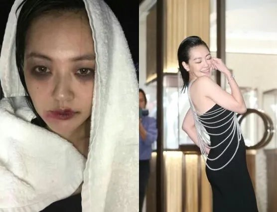 揭秘小s满脸淤青出镜内幕 网友感叹幸亏不是家暴