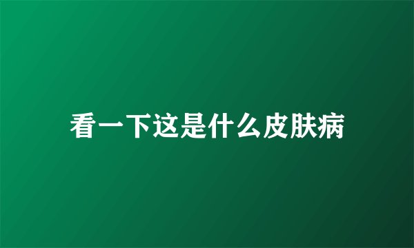 看一下这是什么皮肤病