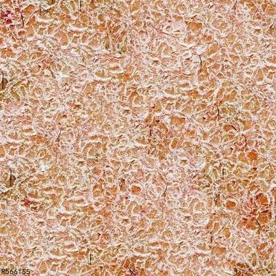 皮肤病查询方法具体有哪些方面