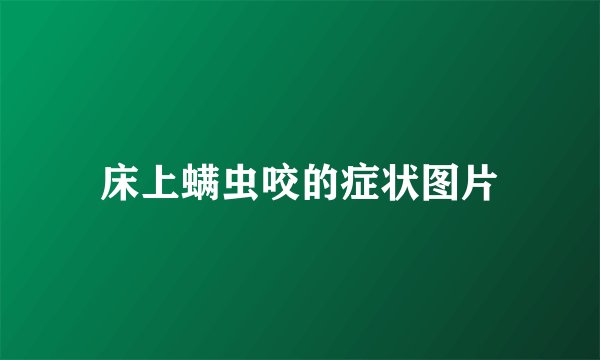 床上螨虫咬的症状图片