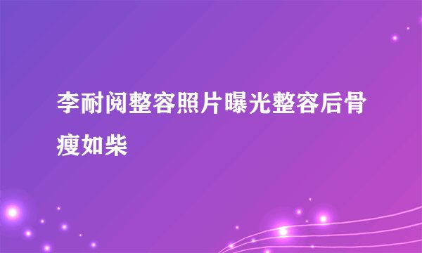 李耐阅整容照片曝光整容后骨瘦如柴