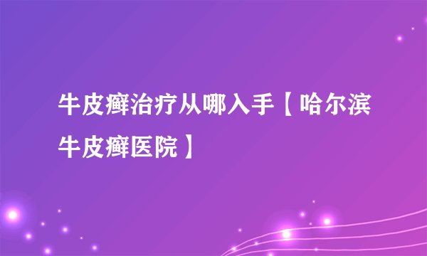 牛皮癣治疗从哪入手【哈尔滨牛皮癣医院】