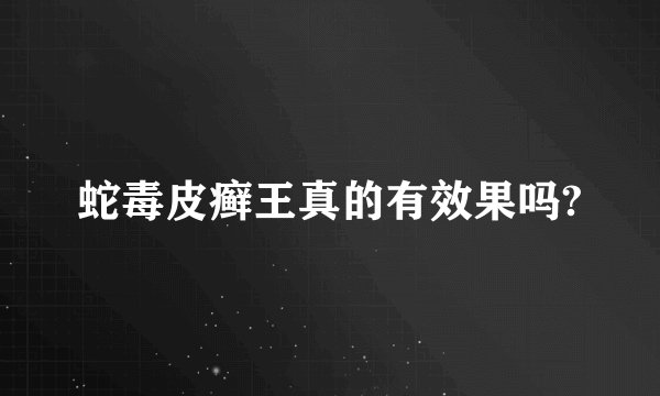 蛇毒皮癣王真的有效果吗?