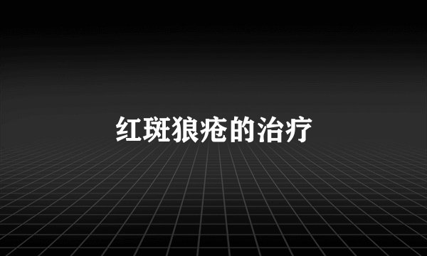 红斑狼疮的治疗