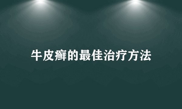 牛皮癣的最佳治疗方法