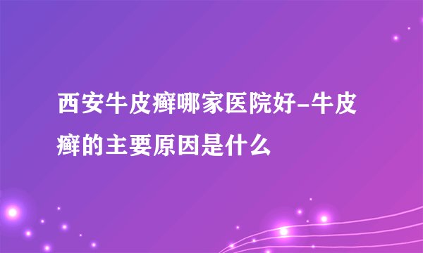 西安牛皮癣哪家医院好-牛皮癣的主要原因是什么