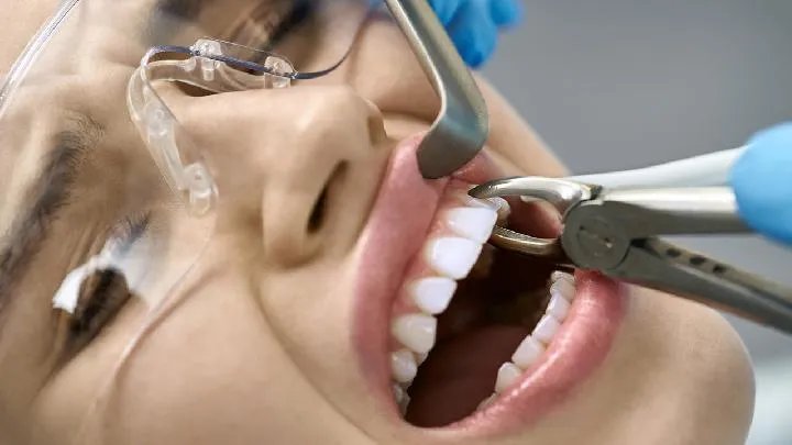 牙源性粘液瘤需要做哪些化验检查