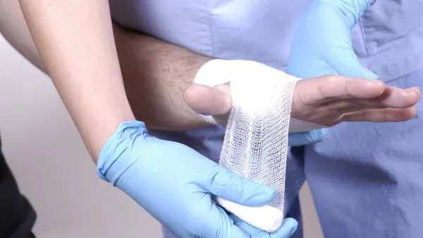 手脱皮是什么原因导致的?手脱皮用什么药效果最好?