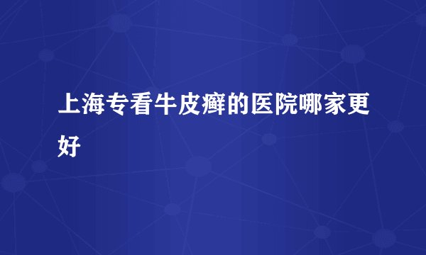 上海专看牛皮癣的医院哪家更好